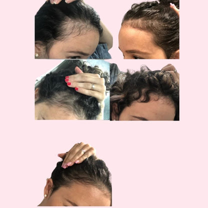 Melenastica Calma Growth and Scalp Hair Serum 30ml